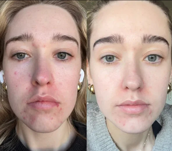 Retelon™-LumiVera Face Mask