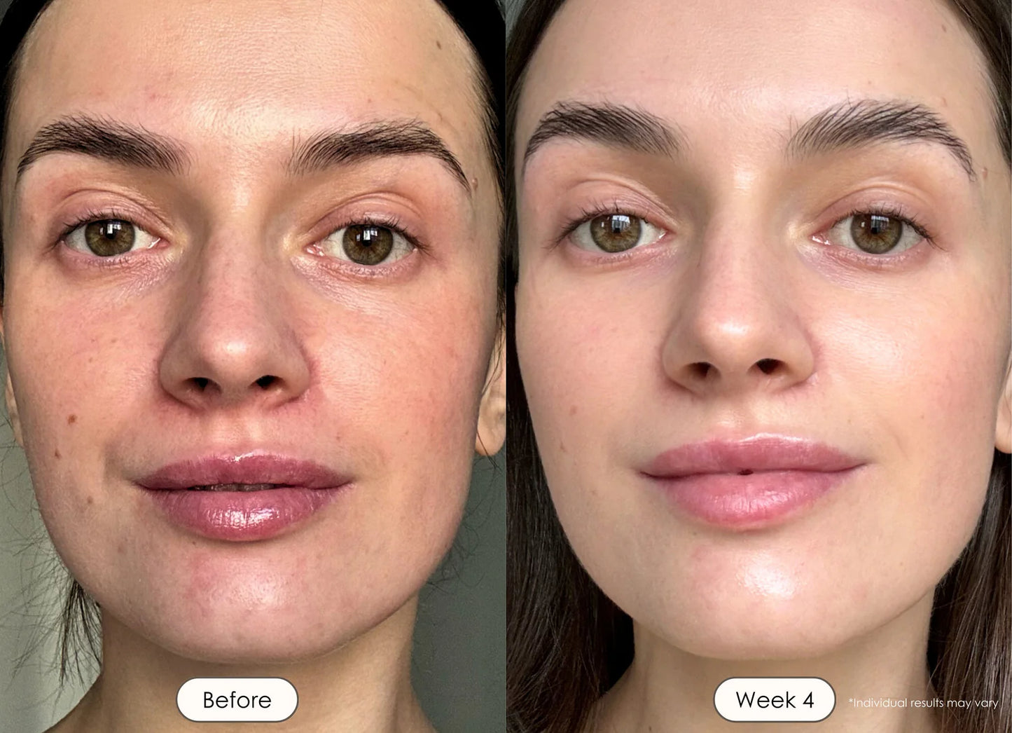 Retelon™-LumiVera Face Mask