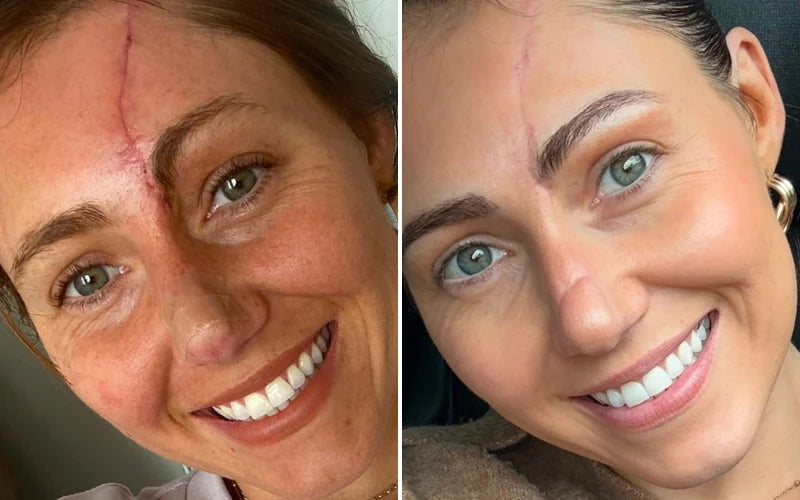 Retelon™-LumiVera Face Mask