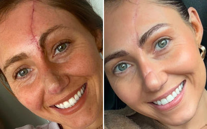 Retelon™-LumiVera Face Mask