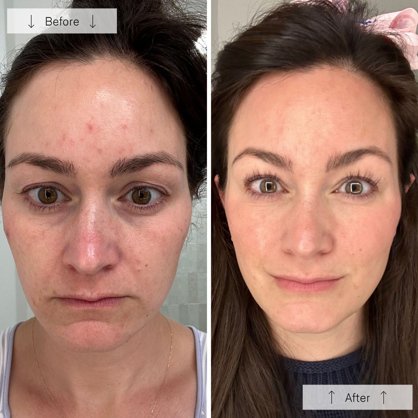 Retelon™-LumiVera Face Mask