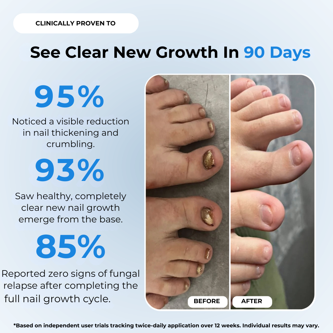 NailRevive™