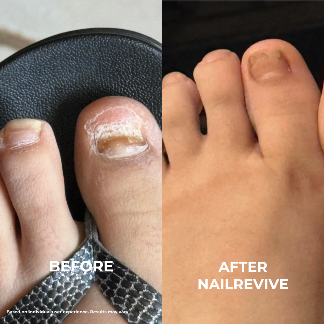NailRevive™