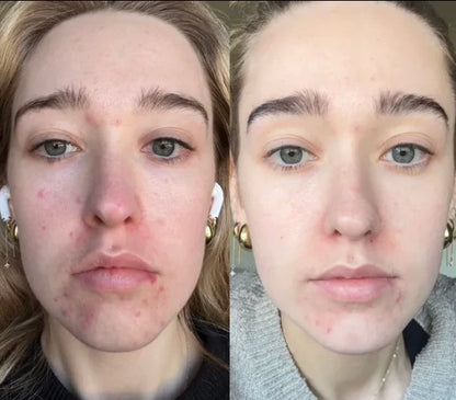 Retelon™-LumiVera Face Mask